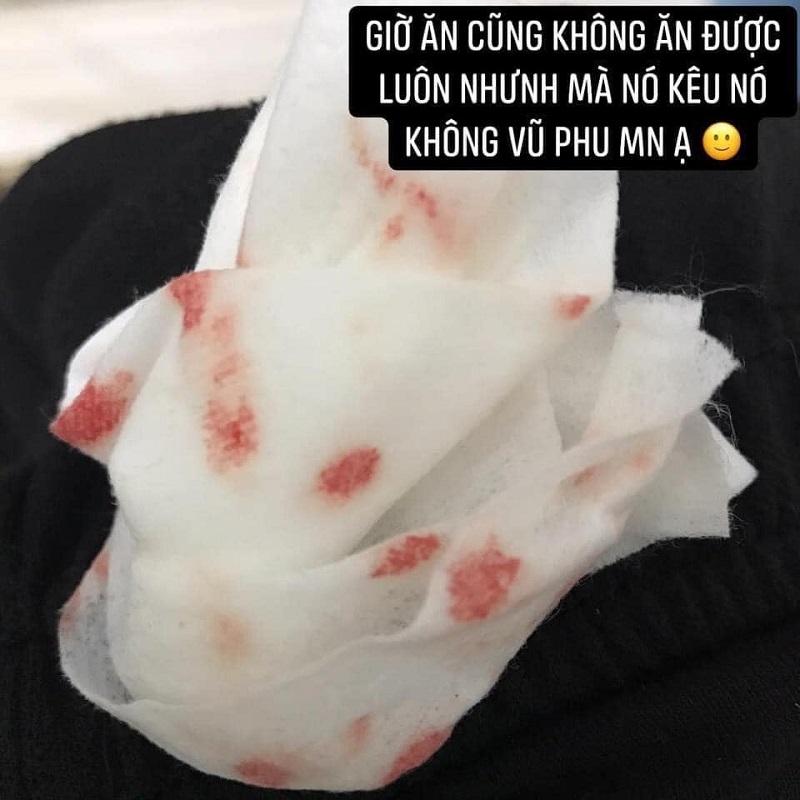 Phát hiện trai lạ thả tim ảnh bạn gái, nam thanh niên ra tay đánh đập người yêu đến bầm dập-2