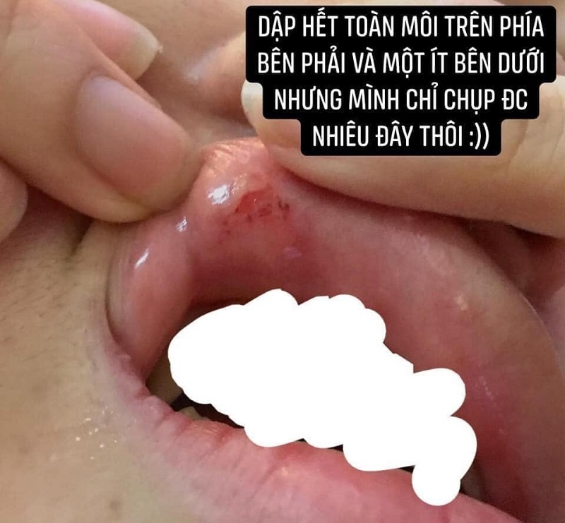 Phát hiện trai lạ thả tim ảnh bạn gái, nam thanh niên ra tay đánh đập người yêu đến bầm dập-3