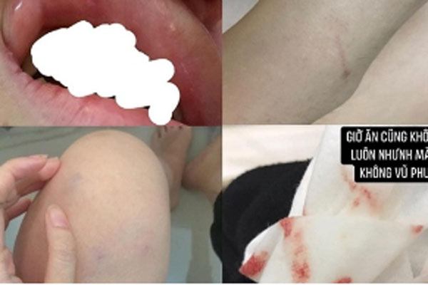 Vụ cô gái bị đánh bầm dập vì có trai lạ thả tim ảnh: Hé lộ clip cảnh người yêu vũ phu và bằng chứng cắm sừng-7