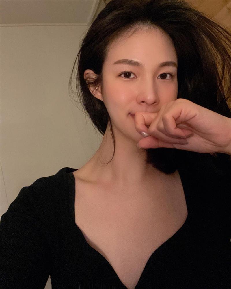 Chuyên gia Hàn Quốc chỉ rõ 5 lầm tưởng về vitamin C, chị em chớ nghe quảng cáo nếu không muốn da toang sau vài ngày sử dụng-2