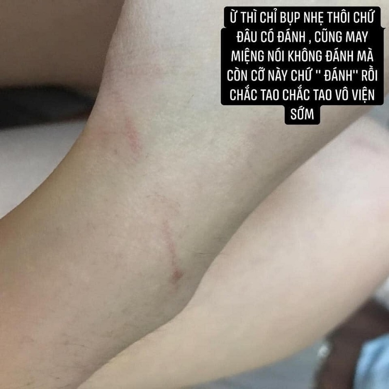 Vụ cô gái bị đánh bầm dập vì có trai lạ thả tim ảnh: Hé lộ clip cảnh người yêu vũ phu và bằng chứng cắm sừng-4