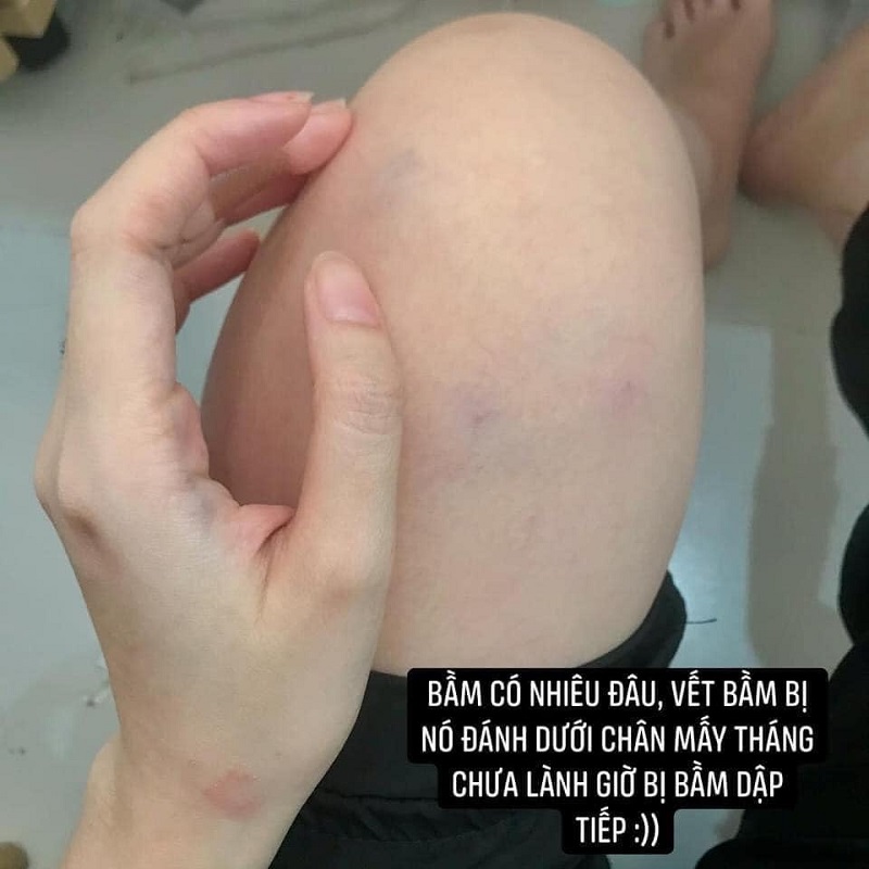 Vụ cô gái bị đánh bầm dập vì có trai lạ thả tim ảnh: Hé lộ clip cảnh người yêu vũ phu và bằng chứng cắm sừng-5