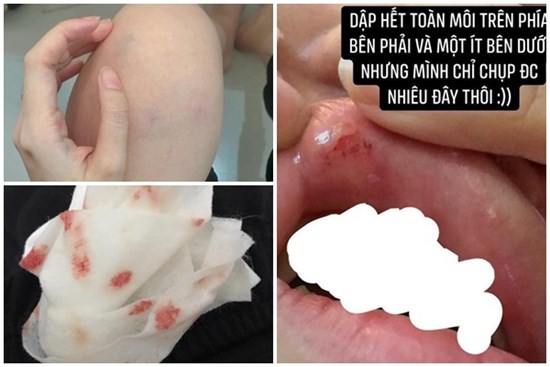 Vụ cô gái bị đánh bầm dập vì có trai lạ thả tim ảnh: Hé lộ clip cảnh người yêu vũ phu và bằng chứng 'cắm sừng'