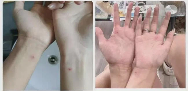 Cách thể hiện tình yêu trời ơi đất hỡi của giới trẻ Trung Quốc: Tự lấy máu cầu bình an cho đối phương, xăm nốt ruồi chu sa làm mật mã riêng-1