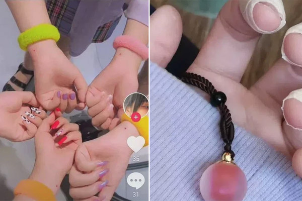 3 nốt ruồi được lộc đất đai, sở hữu 1/3 cũng đủ may mắn, sau 35 tuổi càng vượng phát-4