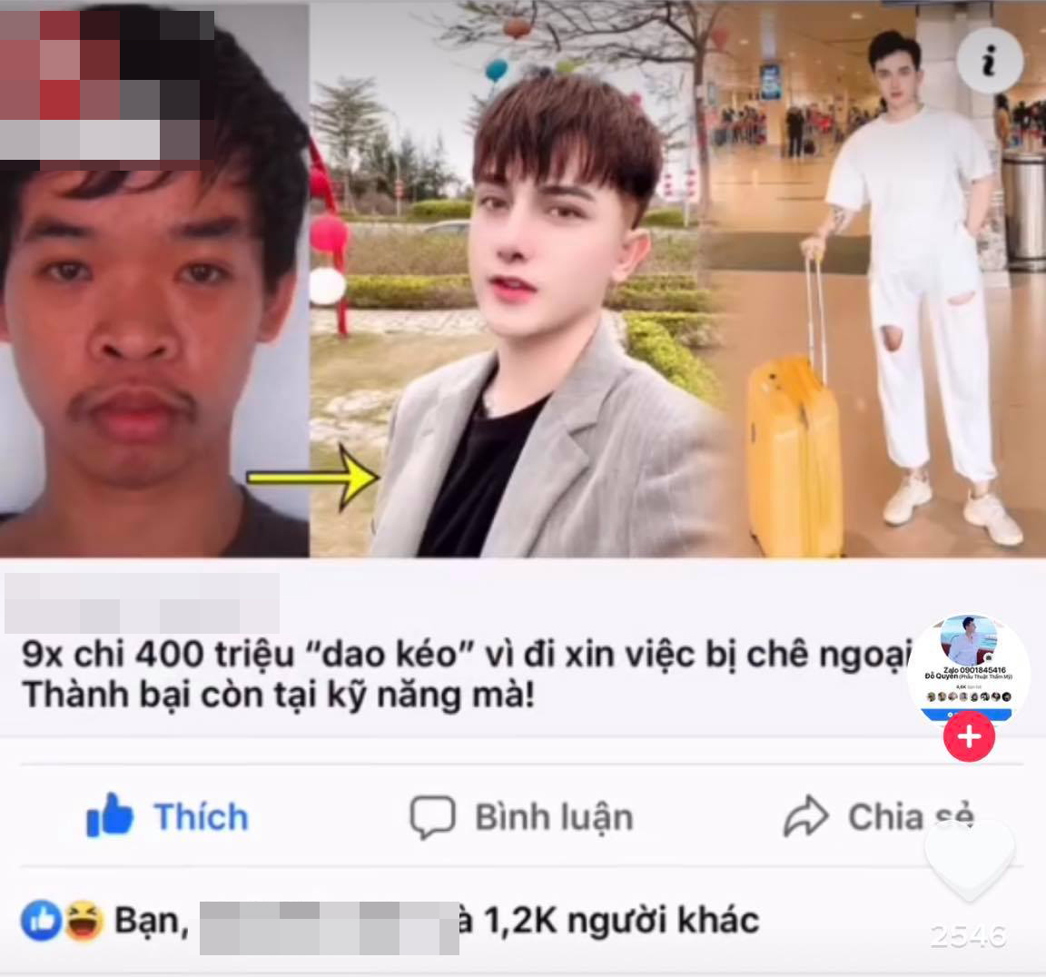 Sự thật màn lột xác của thanh niên Việt lên báo nước ngoài: Lấy ảnh của tội phạm hiếp dâm tự nhận là mình trước phẫu thuật thẩm mỹ-3