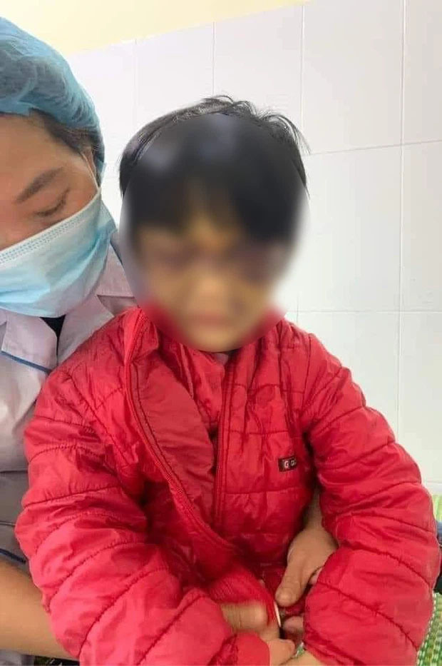 Hải Dương: Bé gái 6 tuổi bị mẹ đẻ bạo hành thâm tím mặt mũi, nhốt trong nhà-1