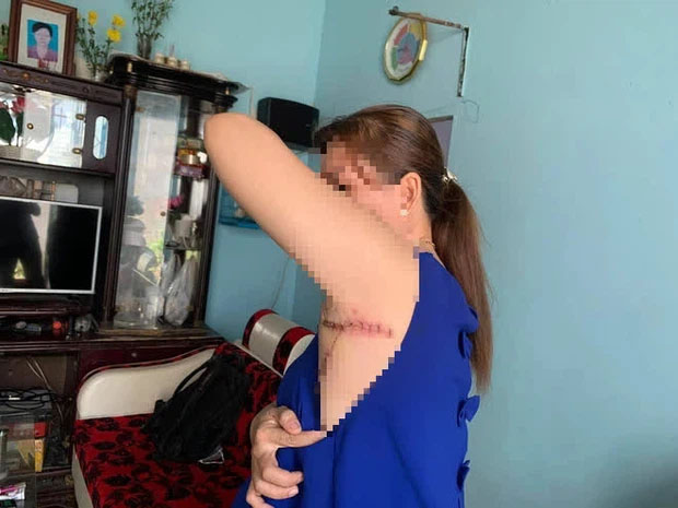 Nhắc nhở hàng xóm xây lấn chiếm vỉa hè, 2 mẹ con bị chém nhiều nhát vào mặt và cơ thể-1