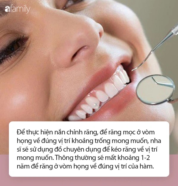 Kéo răng chạy lạc ở vòm họng về trồng đúng vị trí: Clip khiến MXH ngỡ ngàng vì tưởng trò đùa nhưng hóa ra lại là phương pháp hoàn toàn có thật-1