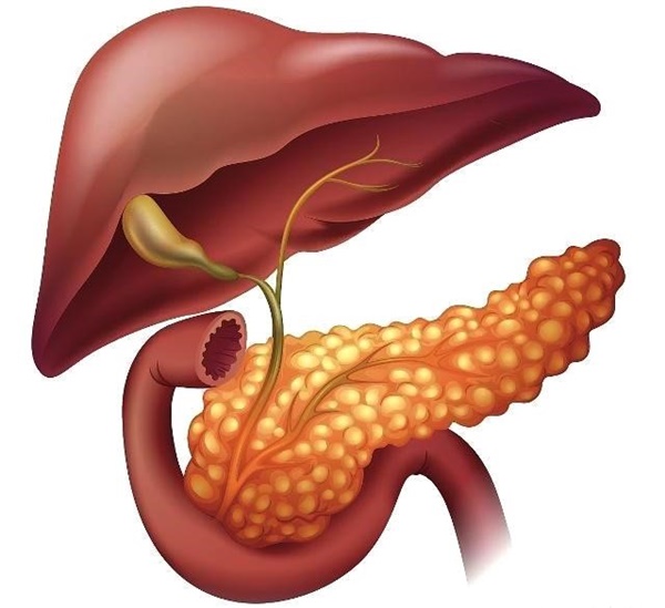 Ung thư tuyến tụy được coi là vua ung thư, nên khám càng sớm càng tốt khi có 3 dấu hiệu này-1