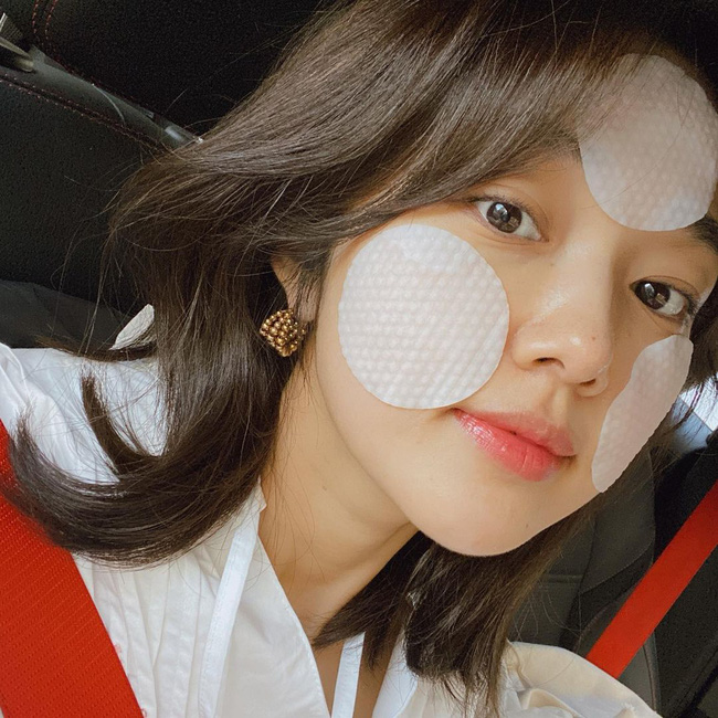 Làn da của Á hậu Huyền My toang nặng vì lỗi tẩy da chết chị em rất dễ sơ sẩy mắc phải-4