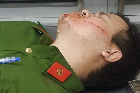 Hai cảnh sát bị chém khi làm nhiệm vụ