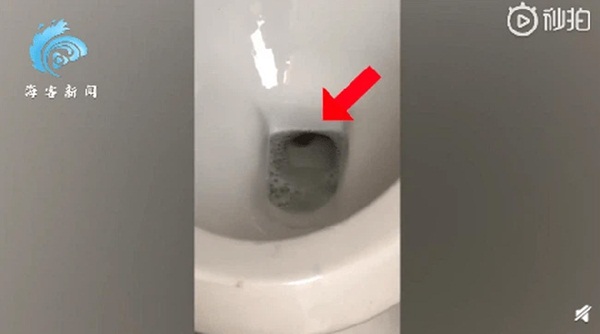 Người đàn ông đi giải quyết nỗi buồn thì suýt ngất trước vật thể lạ dưới bồn cầu nhưng vẫn chưa sợ bằng câu chuyện đôi mắt bí ẩn trong quá khứ-1