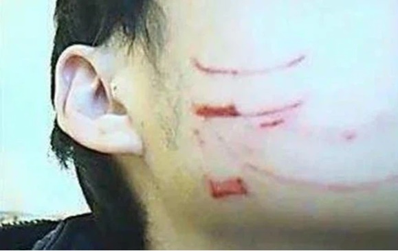 Con trai đi học bị bạn cào nát mặt, mẹ tức tốc đến trường nhưng không làm ầm ĩ, chỉ hỏi đúng 1 câu khiến cô giáo thầm nể phục-1