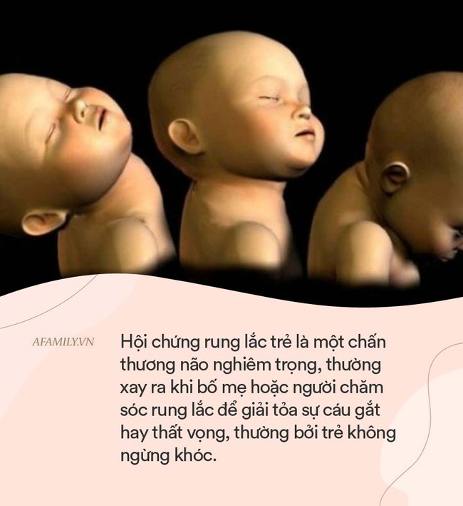 Bé 8 tháng tuổi bị xuất huyết não, đi khám bác sĩ chỉ rõ cách dỗ dành của người bà chính là nguyên nhân hại cháu-3