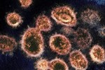 Xuất hiện chủng virus corona giống nCoV đến 94,5%-2