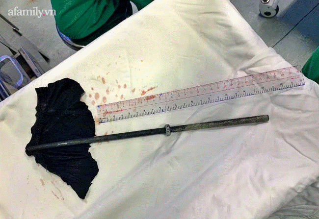 Tai nạn kinh hoàng: Đang sửa máy lạnh thì trượt chân, nam thanh niên bị thanh sắt dài 30cm đâm xuyên cổ nguy kịch-2