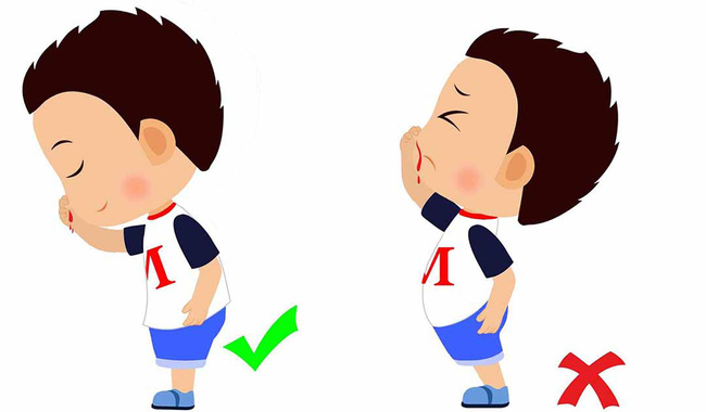 Con bị chảy máu cam, cha mẹ rất hay phạm phải 1 sai lầm này-2