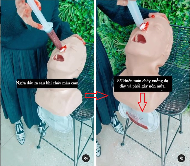 Con bị chảy máu cam, cha mẹ rất hay phạm phải 1 sai lầm này-1