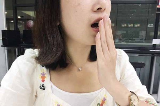 Cô gái cả ngày chỉ ăn bữa tối, nấc từ 3-5 phút/lần, bác sĩ khuyên sau 2 ngày nấc liên tục thì nên đi khám