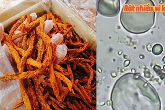 Soi bò khô siêu rẻ 170k/kg bán đầy ngoài chợ dưới kính hiển vi, phát hiện thứ nguyên liệu bất ngờ khiến nhiều người khiếp sợ