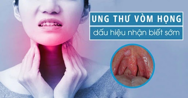 Thiếu niên 15 tuổi bị sưng tấy ở cổ, đến bệnh viện được chẩn đoán ung thư vòm họng, đừng bỏ qua 6 dấu hiệu bệnh ở giai đoạn đầu-2