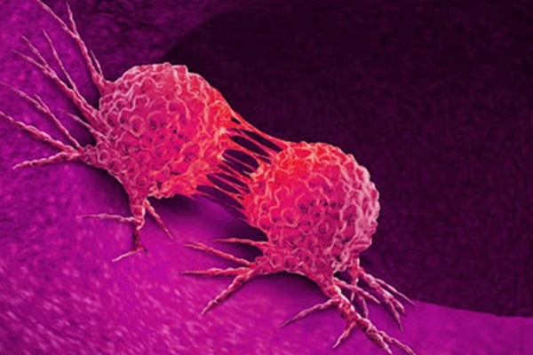 Bệnh ung thư phổ biến nhất tại Châu Á có xu hướng trẻ hoá, ngoài 30 có thể đã mắc: Phòng bệnh bằng cách nào?-1