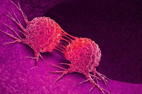 Bệnh ung thư phổ biến nhất tại Châu Á có xu hướng trẻ hoá, ngoài 30 có thể đã mắc: Phòng bệnh bằng cách nào?