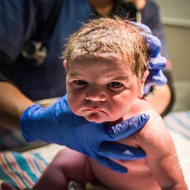 Chùm ảnh: Những em bé sơ sinh có khuôn mặt ông cụ non” khiến cha mẹ được một phen hết hồn nhưng lại gây bão mạng-9