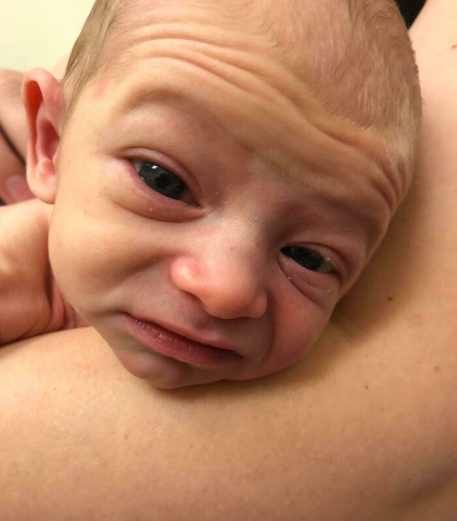 Chùm ảnh: Những em bé sơ sinh có khuôn mặt ông cụ non” khiến cha mẹ được một phen hết hồn nhưng lại gây bão mạng-22