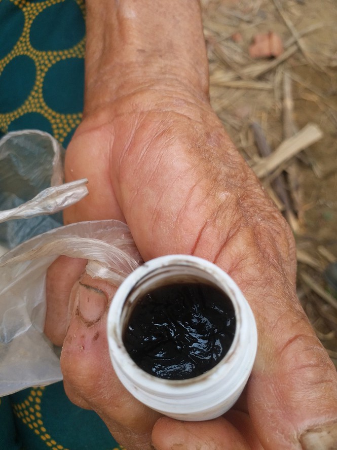 Sự thực thần y Võ Hoàng Yên ra tay chữa bệnh tại Quảng Ngãi-5