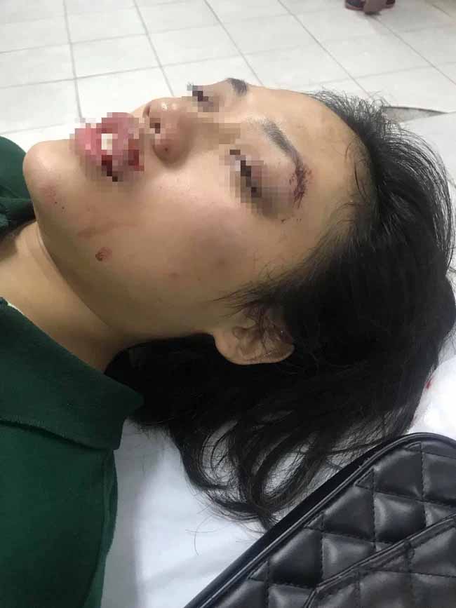 Hà Nội: Phẫn nộ người đàn ông tông nữ giáo viên ngã bất tỉnh rồi rồ ga chạy bỏ mặc nạn nhân-1