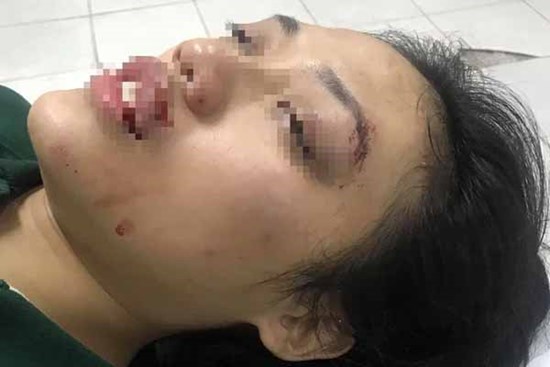 Hà Nội: Phẫn nộ người đàn ông tông nữ giáo viên ngã bất tỉnh rồi rồ ga chạy bỏ mặc nạn nhân