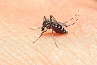 5 cách đuổi muỗi hiệu quả, an toàn, không hóa chất cho nhà có trẻ nhỏ