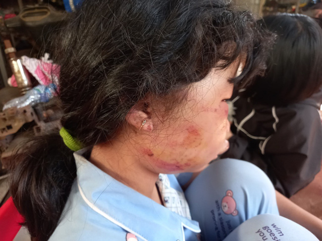 Hình ảnh trước khi bé gái lớp 6 bị người đàn ông bí ẩn đánh dã man, kéo lê vứt xuống hố-3