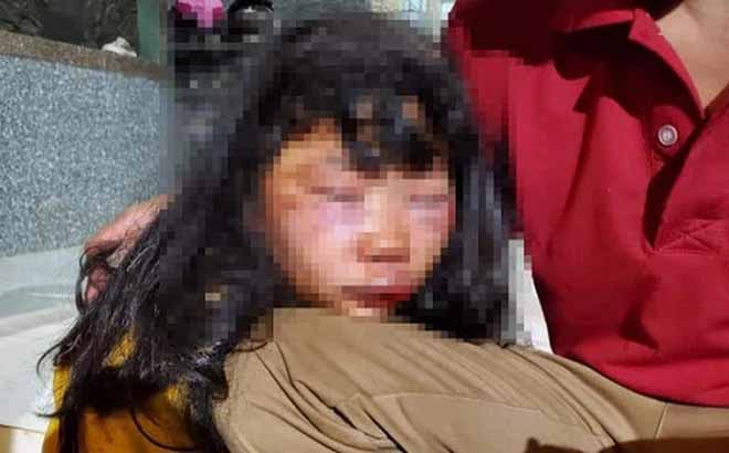 Bắt hung thủ đánh nữ sinh lớp 6 bầm dập, nguyên nhân vụ án có thể vì nghi phạm có tình ý với nạn nhân-1