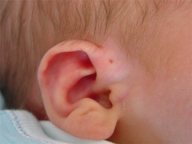 Hết Lisa gặp vấn đề về da, Leon cũng bị chị em bỉm sữa cảnh báo 1 dị tật khiến Hồ Ngọc Hà phải hỏi biểu hiện ngay-6