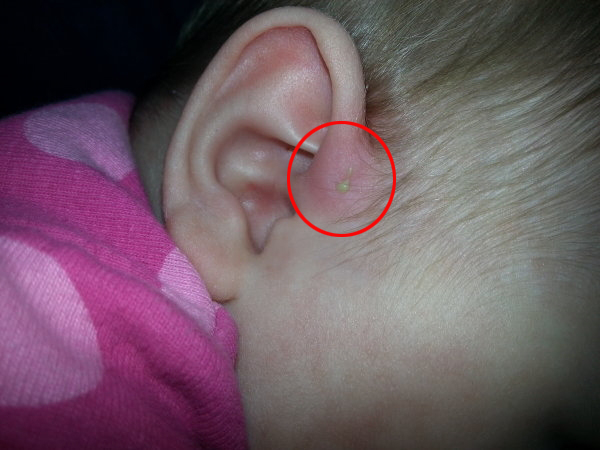 Hết Lisa gặp vấn đề về da, Leon cũng bị chị em bỉm sữa cảnh báo 1 dị tật khiến Hồ Ngọc Hà phải hỏi biểu hiện ngay-7