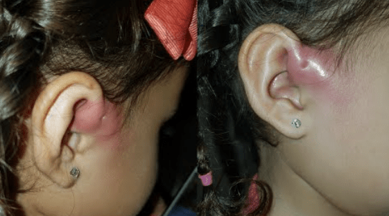 Hết Lisa gặp vấn đề về da, Leon cũng bị chị em bỉm sữa cảnh báo 1 dị tật khiến Hồ Ngọc Hà phải hỏi biểu hiện ngay-8