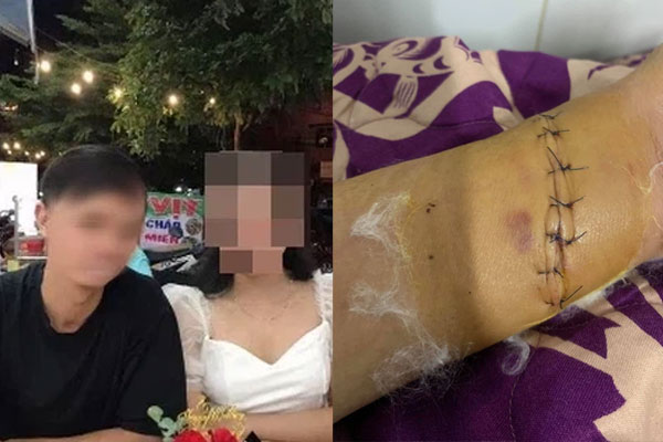 Bố vợ cần tiền phẫu thuật, chồng buông lời bẽ bàng: Con rể chứ đâu phải máy rút tiền, nhờ đó vợ thấm thía sâu sắc 1 điều rồi đưa ra quyết định đanh thép-2