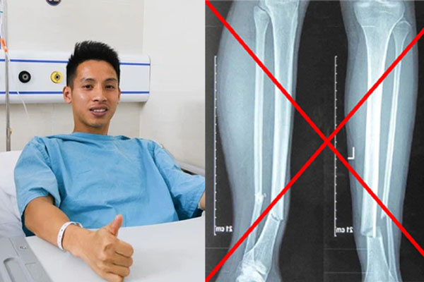 Cái chân là miếng cơm manh áo cầu thủ, sao không giữ cho nhau?-4