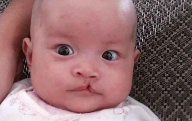 Dù tìm mọi cách nhưng suốt 1 năm qua cặp vợ chồng vẫn không thể mang thai, nhờ một lần bị bong gân chân mà người vợ phát hiện ra sự thật động trời-3