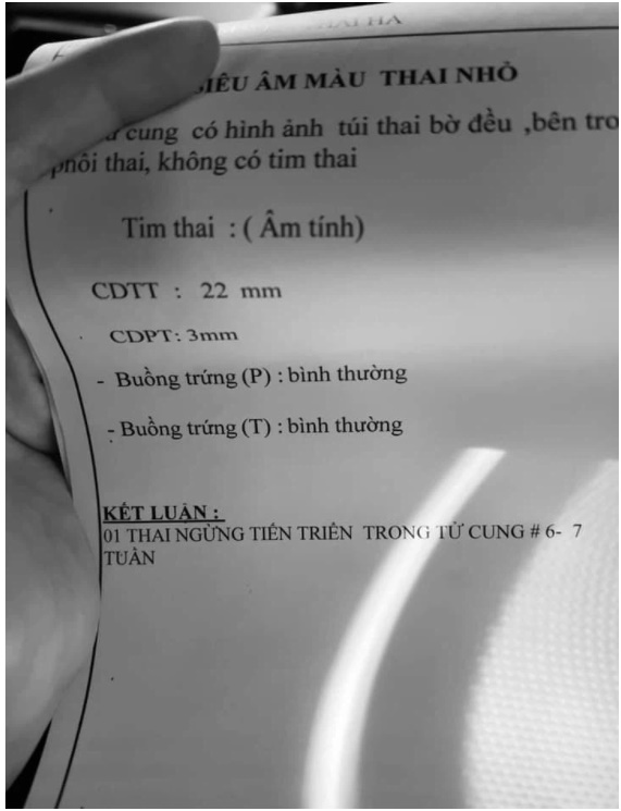 Nữ ca sĩ Việt mang thai lần 4, siêu âm tận 5 lần vẫn không thấy ...