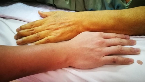 Cà rốt giúp mắt sáng, dáng thon và ngừa ung thư nhưng nếu có 4 dấu hiệu này thì cần ngừng ăn kẻo ôm họa-2