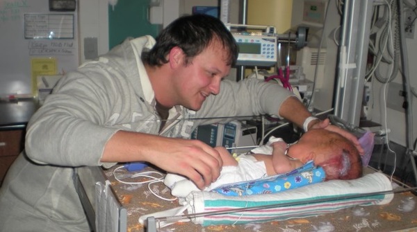 Bé trai sinh ra với căn bệnh não úng thủy, 6 tháng tuổi đã phải lên bàn mổ liên tục, sở hữu dung mạo hiện tại khiến ai cũng trầm trồ-3