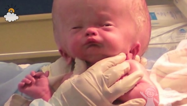 Bé trai sinh ra với căn bệnh não úng thủy, 6 tháng tuổi đã phải lên bàn mổ liên tục, sở hữu dung mạo hiện tại khiến ai cũng trầm trồ-1