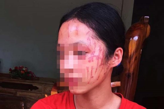 Rùng mình hình ảnh nữ sinh lớp 8 bị 