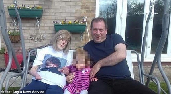 Cô bé từng bỏng nặng đến biến dạng, cứu hoả nhìn cứ ngỡ là búp bê nhựa đen gây bất ngờ với diện mạo và cuộc sống hiện tại-8