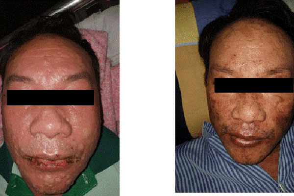 7 thói quen ai cũng đang làm vì tưởng là có ích nhưng hóa ra lại gây hại cực kỳ: Kiểm soát ngay trước khi quá muộn-8