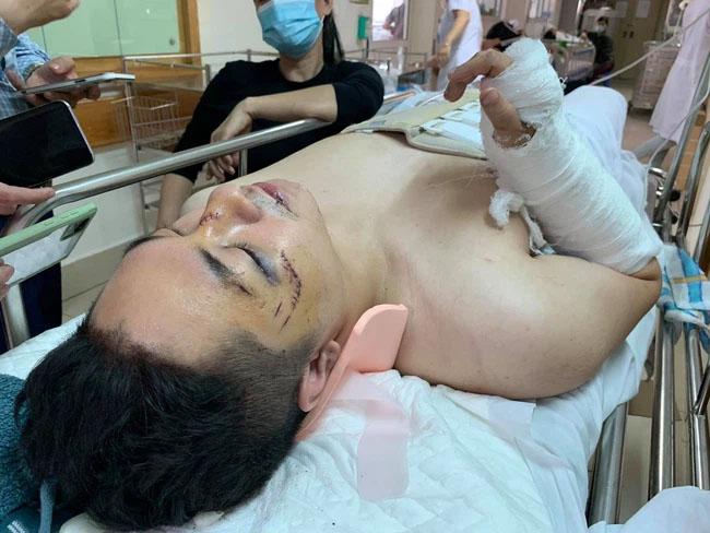 Nạn nhân gãy xương sống vụ chung cư thủng ở Hà Nội kể lại giây phút kinh hoàng: Đầu tôi bị đập vào cửa kính tầng 1, cố đứng dậy nhưng ngã xuống bất tỉnh-1